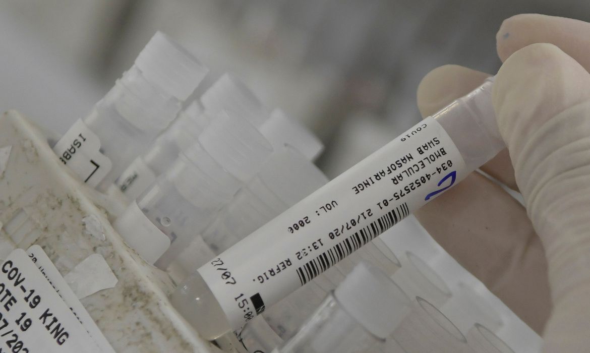 An employee at the Hermes Pardini laboratory shows a sample of the coronavirus disease (COVID-19) testing with PCR amplification, in Vespasiano, near Belo Horizonte, Brazil, July 23, 2020. Picture taken July 23, 2020. REUTERS/Washington Alves