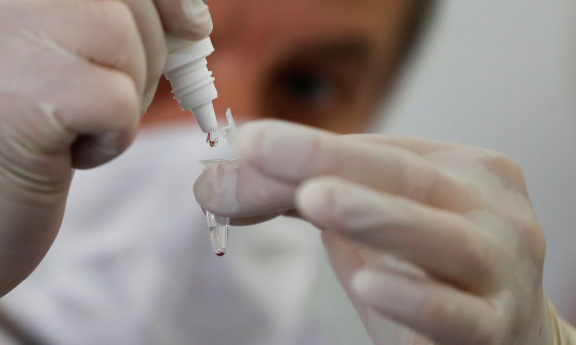 Santiago Webajh, scientist of the Pablo Cassara foundation, puts a drop of reagent in a container during a test of the new "NEOKIT-COVID-19?, developed by a group of Argentine scientists that diagnoses the coronavirus disease (COVID-19) in less than two hours, in Buenos Aires, Argentina May 19, 2020. REUTERS/Agustin Marcarian