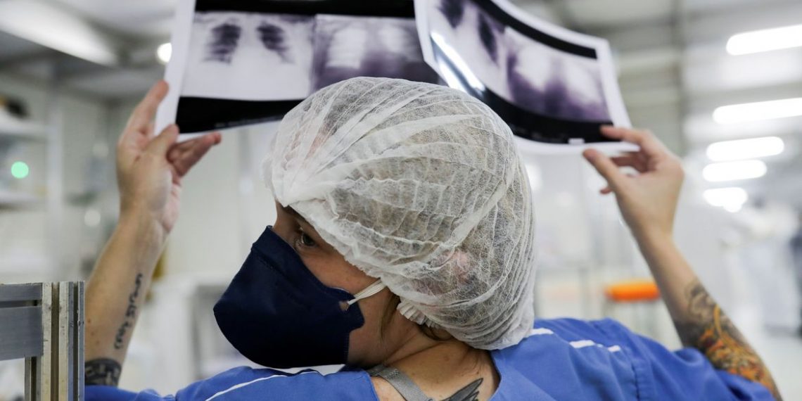 A doutora Luciana Souza compara duas radiografias de tórax diferentes de um paciente enquanto conversa com um colega de um hospital de campanha criado para tratar pacientes que sofrem da doença de coronavírus (COVID-19) em Guarulhos, São Paulo