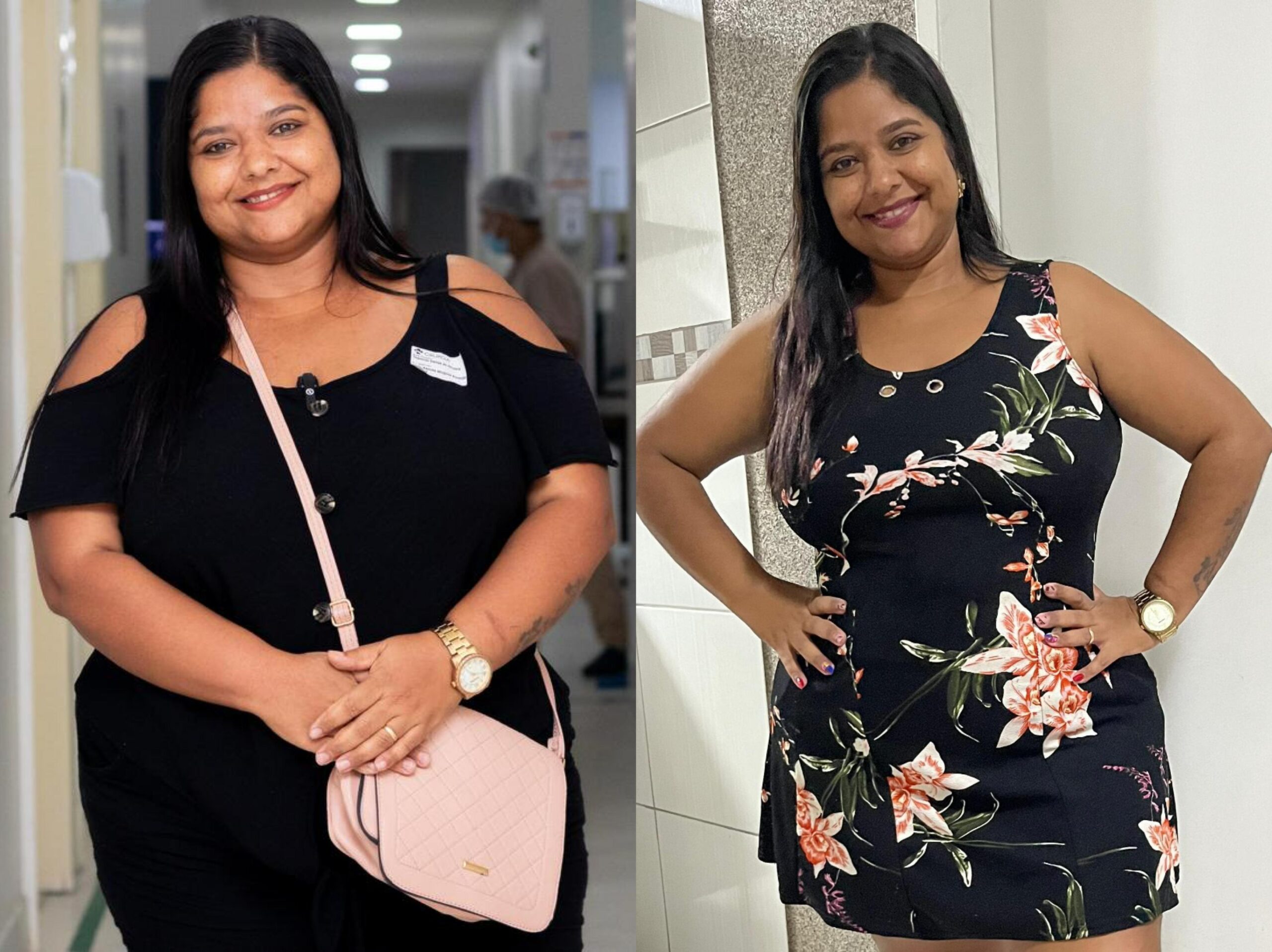 Thamires Santos de Oliveira - antes e depois